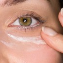 How can I treat my dark circles?